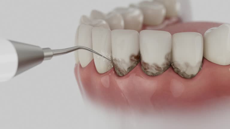 Trusted Tooth Extraction service in Indian River, MI - Dentist Open Now